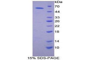 SDS-PAGE (SDS) image for Activated Leukocyte Cell Adhesion Molecule (ALCAM) (AA 28-527) protein (His tag) (ABIN2123892)
