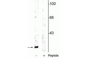 Western blot of rat cortical lysate showing specific immunolabeling of the ~15 kDa alpha synuclein protein phosphorylated at Ser129 in the first lane (-). (SNCA Antikörper  (pSer129))