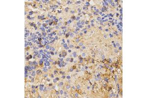 Immunohistochemistry of paraffin-embedded mouse liver fibrosis tissue using CSF2RA antibody at dilution of 1:200 (x400 lens) (CSF2RA Antikörper)