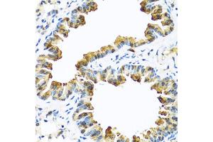 Immunohistochemistry of paraffin-embedded mouse lung using SERPINA10 antibody (ABIN5974273) at dilution of 1/100 (40x lens). (SERPINA10 Antikörper)