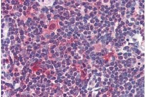 Human Thymus: Formalin-Fixed, Paraffin-Embedded (FFPE) (Caspase 7 Antikörper  (C-Term))