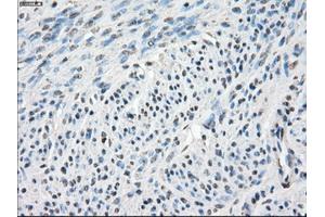 Immunohistochemical staining of paraffin-embedded endometrium tissue using anti-CA9mouse monoclonal antibody. (CA9 Antikörper)