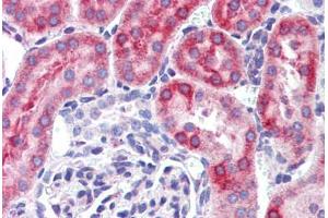 Mouse kidney: Formalin-Fixed, Paraffin-Embedded (FFPE) (IFIH1 Antikörper  (C-Term))