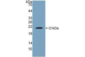 Western blot analysis of recombinant Human NUP210. (NUP210 Antikörper  (AA 1288-1449))