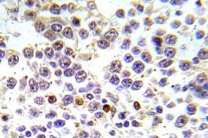 Immunohistochemistry (IHC) analyzes of p-Histone H3. (Histone H3.1 Antikörper  (pSer10))