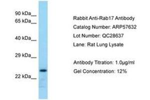 Image no. 1 for anti-RAB17, Member RAS Oncogene Family (RAB17) (AA 121-170) antibody (ABIN6749942)