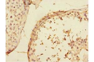 Immunohistochemistry of paraffin-embedded human testis tissue using ABIN7174506 at dilution of 1:100