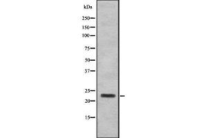 Western blot analysis SAP30 using 293 whole cell lysates (SAP30 Antikörper  (Internal Region))