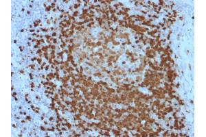 Formalin-fixed, paraffin-embedded human Lymph Node stained with TCL1 Mouse Monoclonal Antibody (TCL1/2079). (TCL1A Antikörper  (AA 2-109))
