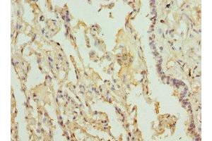 Immunohistochemistry of paraffin-embedded human lung tissue using ABIN7158277 at dilution of 1:100 (LILRB4 Antikörper  (AA 22-259))
