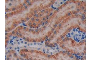 DAB staining on IHC-P; Samples: Mouse Kidney Tissue (JAK3 Antikörper  (AA 517-749))