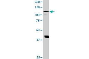 Western Blotting (WB) image for anti-ADAM Metallopeptidase with thrombospondin Type 1 Motif, 17 (ADAMTS17) (AA 543-650) antibody (ABIN566923)