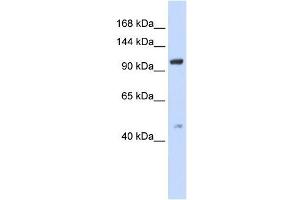 TRPC4 antibody used at 1 ug/ml to detect target protein.