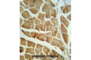 CAPN3 Antibody (C-term) IHC analysis in formalin fixed and paraffin embedded skeletal muscle followed by peroxidase conjugation of the secondary antibody and DAB staining. (Calpain 3 Antikörper  (C-Term))