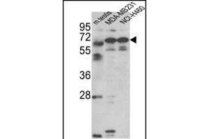 Western blot analysis of Fascin-3 Antibody (N-term) (ABIN390722 and ABIN2840998) in MDA-M, NCI- cell line and mouse testis tissue lysates (35 μg/lane). (Fascin 3 Antikörper  (N-Term))