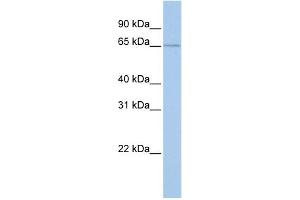 WB Suggested Anti-GPR161 Antibody Titration:  0.