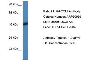 Western Blotting (WB) image for anti-Actin, alpha 1, Skeletal Muscle (ACTA1) (N-Term) antibody (ABIN2788636) (Actin Antikörper  (N-Term))