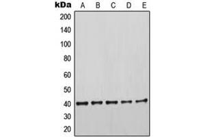 Western blot analysis of Cytokeratin 19 expression in HeLa (A), MCF7 (B), SKBR3 (C), MDAMB435 (D), HEK293T (E) whole cell lysates. (Cytokeratin 19 Antikörper  (Center))