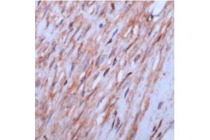 Image no. 1 for anti-Actin, beta (ACTB) (N-Term) antibody (ABIN5611427)