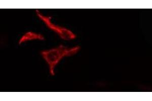 ABIN6278571 staining  HT29 cells by IF/ICC. (FZD7 Antikörper  (C-Term))