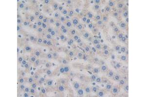 Immunohistochemistry (IHC) image for anti-Transferrin (TF) (AA 380-565) antibody (ABIN1860869)
