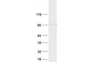 Western Blotting (WB) image for Signal-Regulatory Protein alpha (SIRPA) (Transcript Variant 1) protein (Myc-DYKDDDDK Tag) (ABIN2713468)