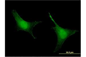 Immunofluorescence of monoclonal antibody to PREP on HeLa cell.