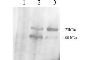 Western Blotting (WB) image for anti-Proprotein Convertase Subtilisin/kexin Type 9 (PCSK9) (AA 679-692) antibody (ABIN296977) (PCSK9 Antikörper  (AA 679-692))