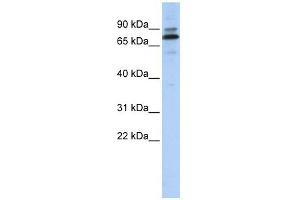 C14ORF21 antibody used at 1 ug/ml to detect target protein. (C14orf21 Antikörper  (Middle Region))