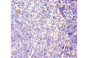 Immunohistochemistry of paraffin-embedded human lymphoid tissue using ABIN7170927 at dilution of 1:100 (OXCT1 Antikörper  (AA 40-520))