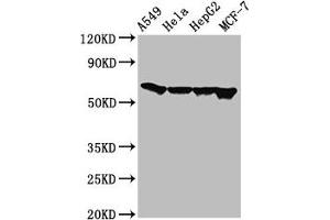 Western Blot Positive WB detected in: A549 whole cell lysate, Hela whole cell lysate, HepG2 whole cell lysate, MCF-7 whole cell lysate All lanes: FZD10 antibody at 3 μg/mL Secondary Goat polyclonal to rabbit IgG at 1/50000 dilution Predicted band size: 66 kDa Observed band size: 66 kDa (FZD1 Antikörper  (AA 125-225))