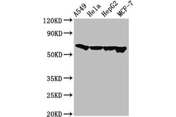 FZD1 抗体  (AA 125-225)