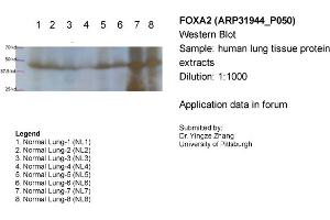 Sample Type: Human lung tissue protein extractsPrimary Dilution: 1:1000Secondary (Anti-Rabbit HRP sc-2004) Dilution: 1:1000