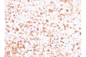 Formalin-fixed, paraffin-embedded human Tonsil stained with Lambda Light Chain Recombinant Mouse Monoclonal Antibody (rLLC/3777). (Rekombinanter IgL Antikörper)