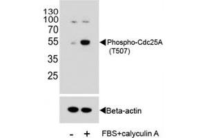 Western blot analysis of extracts from HeLa cells, untreated or treated with Calyculin A, using phospho-Cdc25A antibody.