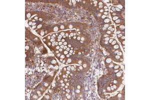 Immunohistochemical staining of human small intestine with FCHO2 polyclonal antibody  shows moderate cytoplasmic positivity in glandular cells. (FCHO2 Antikörper)