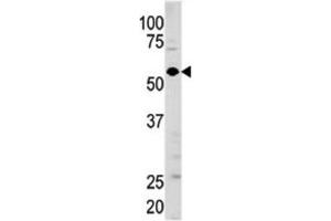 Western Blotting (WB) image for anti-Guanylate Cyclase 1 Soluble Subunit Alpha (GUCY1A1) antibody (ABIN3003008) (GUCY1A1 Antikörper)