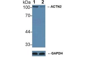 Western blot analysis of (1) Wild-type HeLa cell lysate, and (2) ACTN2 knockout HeLa cell lysate, using Rabbit Anti-Mouse ACTN2 Antibody (1 µg/ml) and HRP-conjugated Goat Anti-Mouse antibody ( (ACTN2 Antikörper  (AA 1-254))