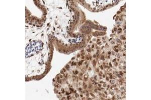 Immunohistochemical staining of human placenta with RPL12 polyclonal antibody  shows strong cytoplasmic positivity in trophoblastic cells and decidual cells at 1:20-1:50 dilution. (RPL12 Antikörper)