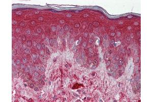 Immunohistochemistry (IHC) image for anti-Decorin (DCN) (N-Term) antibody (ABIN2783275)