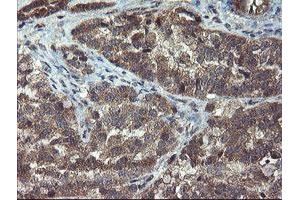 Image no. 3 for anti-Crystallin, Zeta, Homolog antibody (ABIN1497658) (CRYZL1 Antikörper)