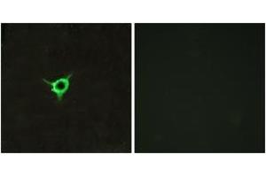 Immunofluorescence analysis of LOVO cells, using CNR1 Antibody. (CNR1 Antikörper  (AA 151-200))