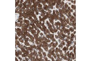 Immunohistochemical staining (Formalin-fixed paraffin-embedded sections) of human liver shows strong cytoplasmic positivity in hepatocytes. (Glucose-6-Phosphate Dehydrogenase Antikörper  (AA 43-154))