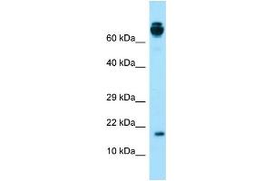 Western Blotting (WB) image for anti-Vitamin K-dependent protein C (PROC) (Middle Region) antibody (ABIN2774395)