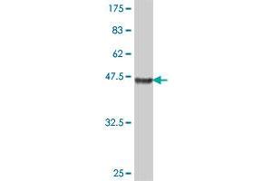 Western Blot detection against Immunogen (41. (TOMM22 Antikörper  (AA 1-142))