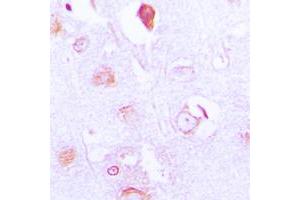 Immunohistochemical analysis of FXR2 staining in human brain formalin fixed paraffin embedded tissue section. (FXR2 Antikörper  (C-Term))