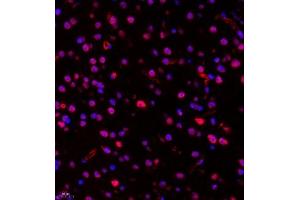 Immunofluorescence of paraffin embedded mouse Brain using RB1 (ABIN7075477) at dilution of 1:1400 (400x lens) (RBM45 Antikörper)
