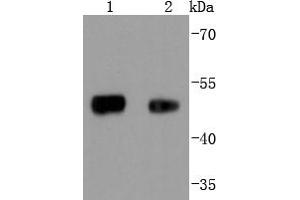 Lane 1: 293 lysates, Lane 2: Mouse lung lysates probed with FOXA1 (5F7) Monoclonal Antibody  at 1:1000 overnight at 4˚C.
