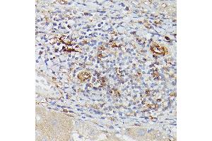 Immunohistochemistry of paraffin-embedded human liver using ENTPD1/CD39 Rabbit pAb (ABIN1679729, ABIN3018088, ABIN3018089 and ABIN6220354) at dilution of 1:25 (40x lens). (CD39 Antikörper  (AA 1-180))