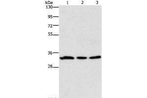 Western Blot analysis of 293T and Human colon cancer tissue, 231 cell using GPA33 Polyclonal Antibody at dilution of 1:600 (GPA33 Antikörper)